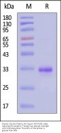 Human COL1A1 Protein, His Tag, low endotoxin (MALS verified)