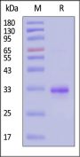 Human COL1A1 Protein, His Tag, low endotoxin (MALS verified)