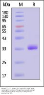 Mouse COL1A1 Protein, His Tag, low endotoxin (MALS verified)