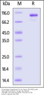 Cynomolgus Complement C2 Protein, His Tag (active enzyme)