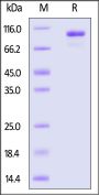 Cynomolgus Complement C2 Protein, His Tag (active enzyme)