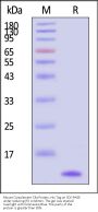Mouse Complement C3a Protein, His Tag (HPLC verified)