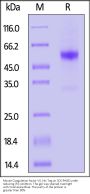 Mouse Coagulation factor VII Protein, His Tag (active enzyme, MALS verified)