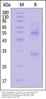 Human Complement C1s Protein, His Tag