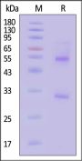 Human Complement C1s Protein, His Tag