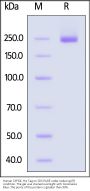 Human CSPG4 / MCSP Protein, His Tag (MALS verified)
