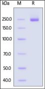 Human CSPG4 / MCSP Protein, His Tag (MALS verified)