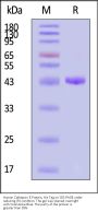 Human Cathepsin E Protein, His Tag (active enzyme, MALS verified)