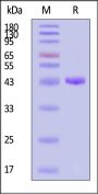 Human Cathepsin E Protein, His Tag (active enzyme, MALS verified)