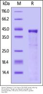 Human Cathepsin S / CTSS Protein, His Tag (active enzyme, MALS verified)
