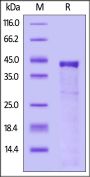 Human Cathepsin S / CTSS Protein, His Tag (active enzyme, MALS verified)