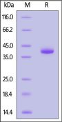 Human CXCL2 Protein, Fc Tag (MALS verified)