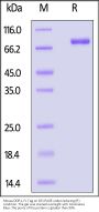 Mouse DDR1 Protein, Fc Tag