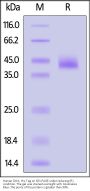 Human DLK1 / FA1 Protein, His Tag (MALS verified)