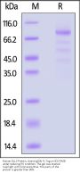 Human DLL3 Protein, Llama IgG2b Fc Tag