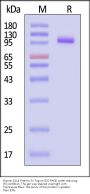 Human DLL4 Protein, Fc Tag, low endotoxin (MALS & SPR verified)
