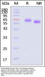 Biotinylated Human DLL4 Protein, His,Avitag™, premium grade