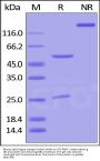 Mouse IgG1 Kappa Isotype Control (mAb, Carrier free, MALS verified)
