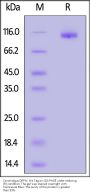 Cynomolgus DPPIV / CD26 Protein, His Tag, active dimer (active enzyme, MALS verified)