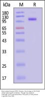 Biotinylated Human DPPIV Protein, His,Avitag™ (active enzyme)