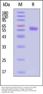 Biotinylated Human DR3 / TNFRSF25 Protein, Fc,Avitag™ (MALS verified)