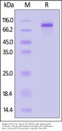 Rabbit EGF R Protein, His Tag (MALS verified)