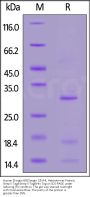 Human Elongin B&Elongin C&VHL Heterotrimer Protein, Strep II Tag&Strep II Tag&His Tag (MALS&SPR verified)