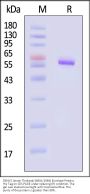 DENV2 (strain Thailand/16681/1984) Envelope Protein, His Tag (MALS verified)