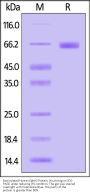 Biotinylated Human EphA2 Protein, His,Avitag™ (MALS verified)