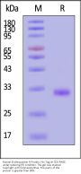 Human Erythropoietin R / EPO R Protein, His Tag (MALS & SPR verified)