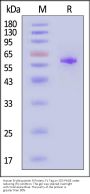 Human Erythropoietin R / EPO R Protein, Fc Tag (MALS verified)