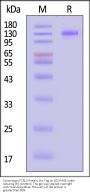 Cynomolgus FCRL5 Protein, His Tag, low Endotoxin (MALS verified)