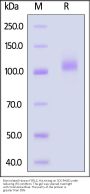 Biotinylated Human FCRL5 Protein, His,Avitag™ (MALS & SPR verified)