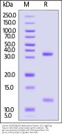 Canine FcRn / FCGRT&B2M Heterodimer Protein, His Tag&Tag Free (MALS & SPR verified)