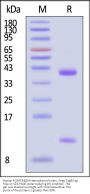 Human FcRn / FCGRT&B2M Heterodimer Protein, Strep Tag&Tag Free (MALS & SPR verified)