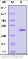 Human FGF-3 / HBGF-3 Protein, His Tag