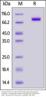 Human FGF R4 / CD334 Protein, Fc Tag (MALS & SPR verified)