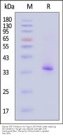 Human FGF-5 Protein, His Tag (SPR verified)