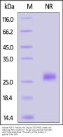 Human FGF-7 / HBGF-7 / KGF Protein, His Tag (HPLC & SPR verified)