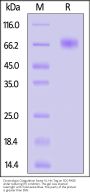 Cynomolgus Coagulation factor IX / F9 Protein, His Tag (active enzyme, MALS verified)