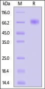 Cynomolgus Coagulation factor IX / F9 Protein, His Tag (active enzyme, MALS verified)