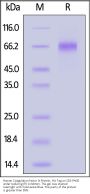 Human Coagulation factor IX / F9 Protein, His Tag (active enzyme, MALS verified)