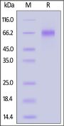 Human Coagulation factor IX / F9 Protein, His Tag (active enzyme, MALS verified)