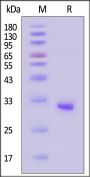 Human FOLR4 Protein, His Tag (MALS verified)
