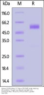 Human GCGR / Glucagon receptor Protein, Fc Tag, low Endotoxin (MALS verified)
