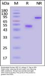 Biotinylated Human GDF-15 / MIC-1 Protein, Avitag™, Fc Tag (MALS verified)