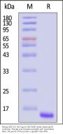 Mouse GDF-15 / MIC-1 Protein, His Tag