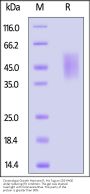Cynomolgus Growth Hormone R (GHR) Protein, His Tag