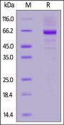 Human Glucosylceramidase Protein, His Tag