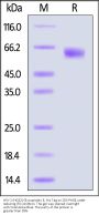 HSV-2 (HG52) Glycoprotein E Protein, His Tag (MALS verified)